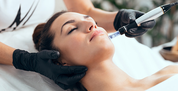 Microagulhamento Facial